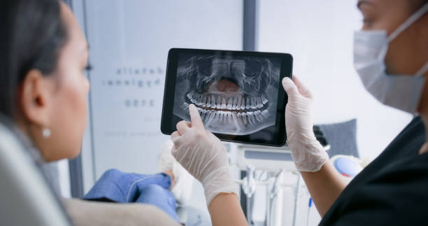 Licensed Tooth Extraction service in North Springfield, VA - Smile Center Dentistry
